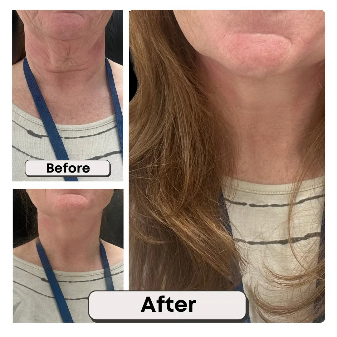 Instant Lift Neck Tape